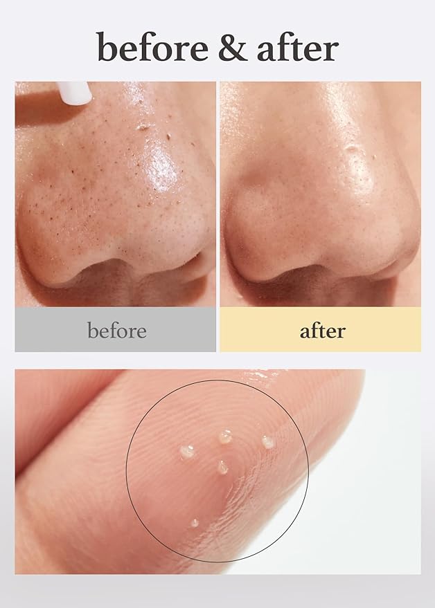NOONI Cleansing Oil - Snow Aqua 0 LHA Toning Pore Care Korean Facial Oil Cleanser, 6.76 fl.oz (200 ml)*2EA + Pore Cleansing Tool - Manual Dual Brush Bundle