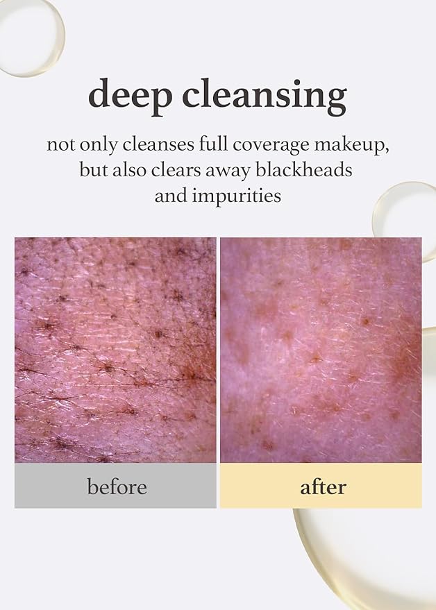 NOONI Cleansing Oil - Snow Aqua 0 LHA Toning Pore Care Korean Facial Oil Cleanser, 6.76 fl.oz (200 ml)*2EA + Pore Cleansing Tool - Manual Dual Brush Bundle
