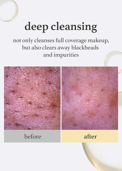 NOONI Cleansing Oil - Snow Aqua 0 LHA Toning Pore Care Korean Facial Oil Cleanser, 6.76 fl.oz (200 ml)*2EA + Pore Cleansing Tool - Manual Dual Brush Bundle